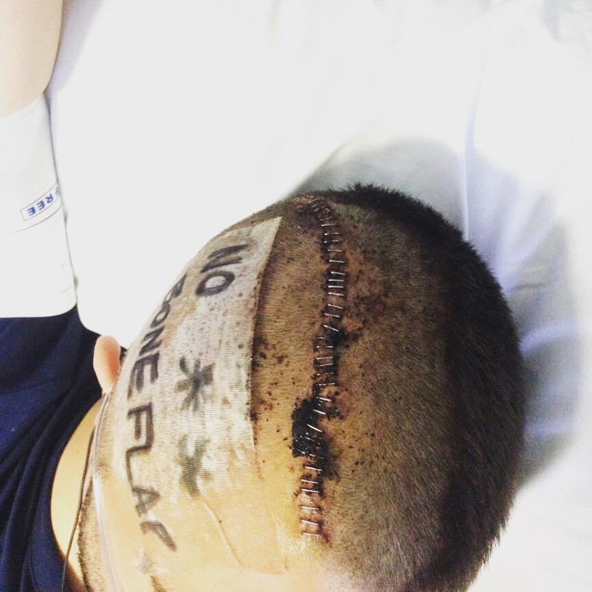 stroke exercise charity